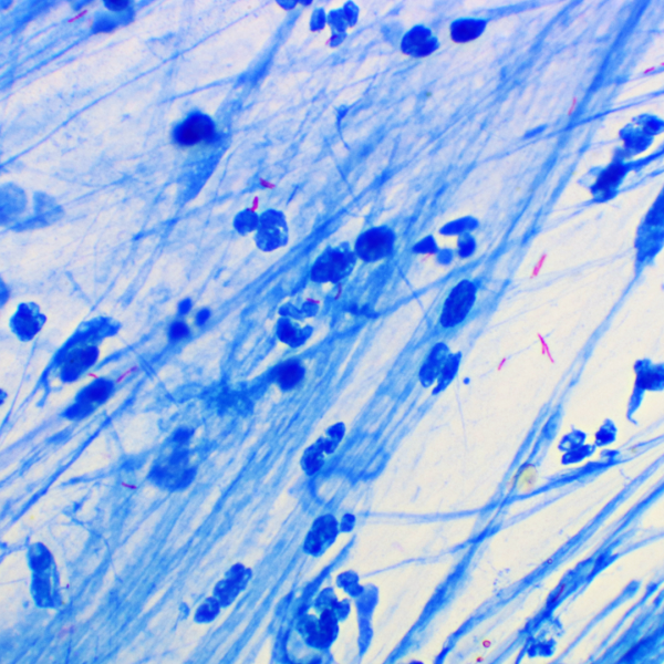Blue growths are seen under a microscope